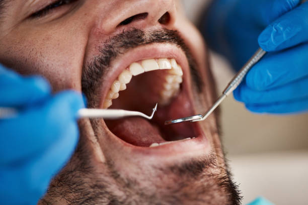 Best Emergency Cosmetic Dentistry (e.g., broken veneers) in Weirton, WV